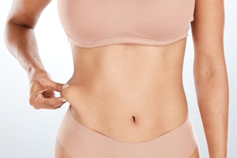 abdominoplastie