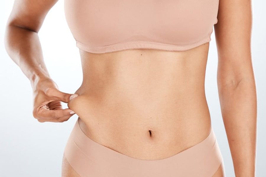 abdominoplastie